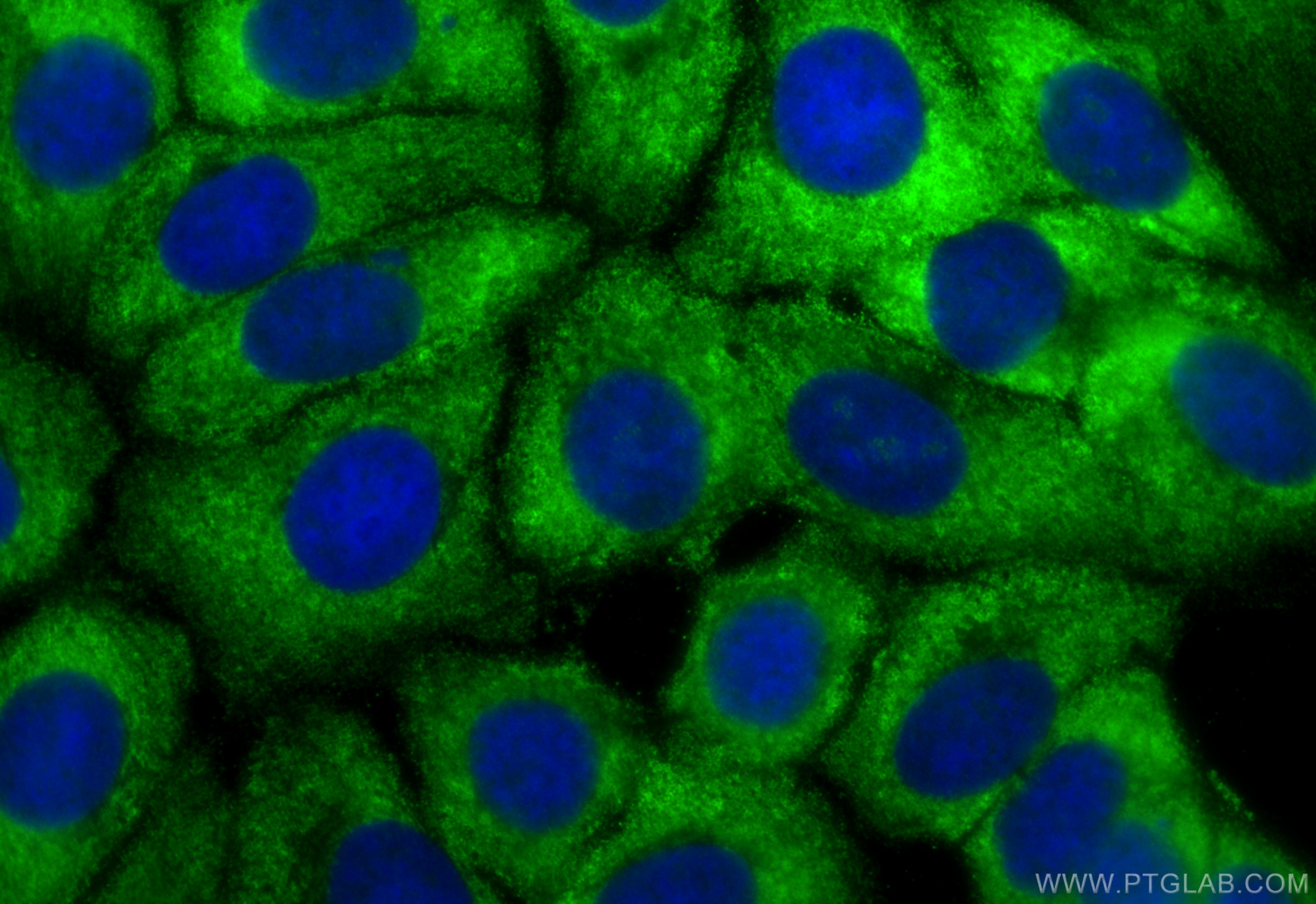 Immunofluorescence (IF) / fluorescent staining of MCF-7 cells using CoraLite® Plus 488-conjugated PSME1 Monoclonal ant (CL488-67928)