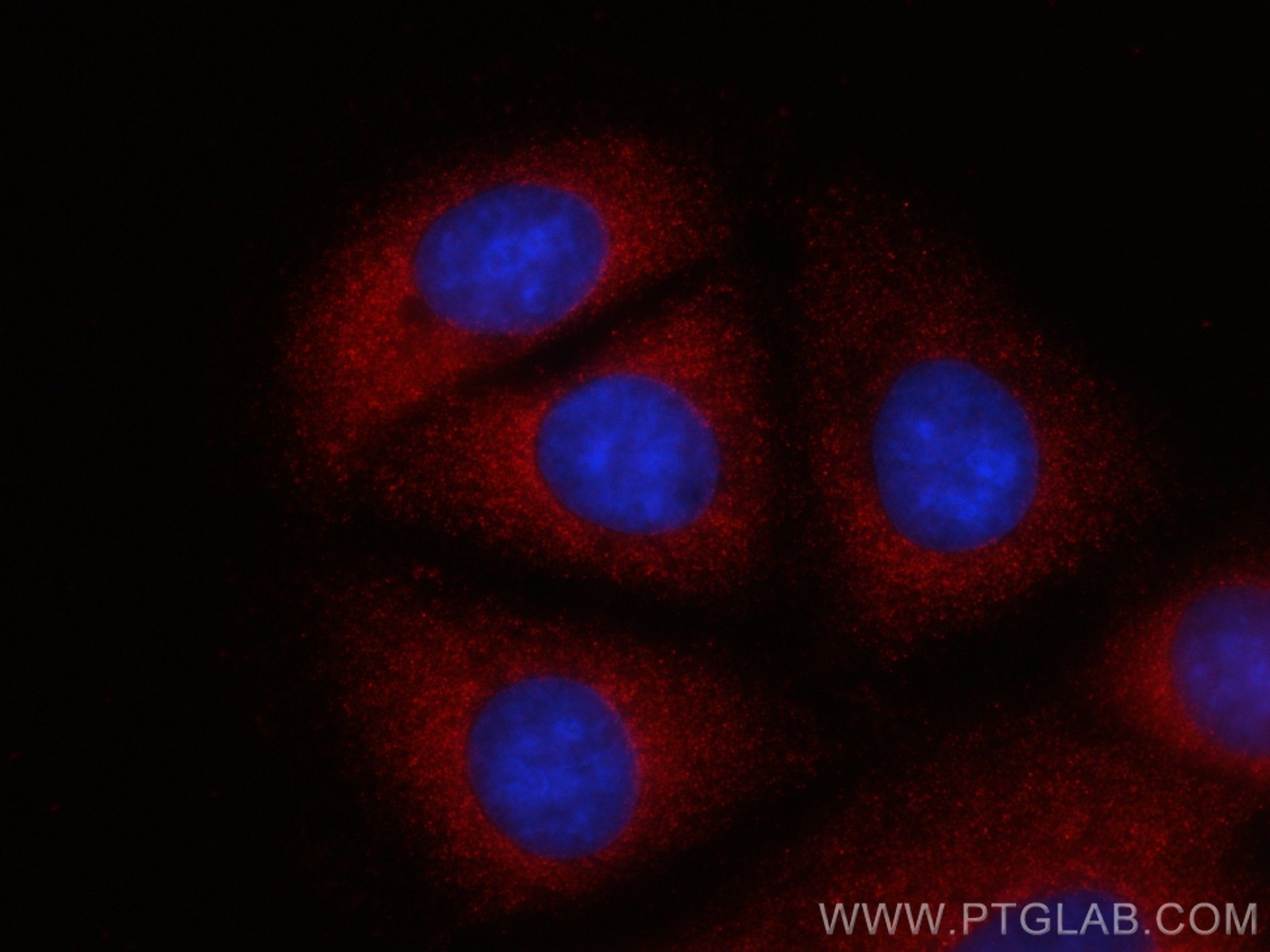 Immunofluorescence (IF) / fluorescent staining of MCF-7 cells using CoraLite®594-conjugated PSME1 Monoclonal antibody (CL594-67928)