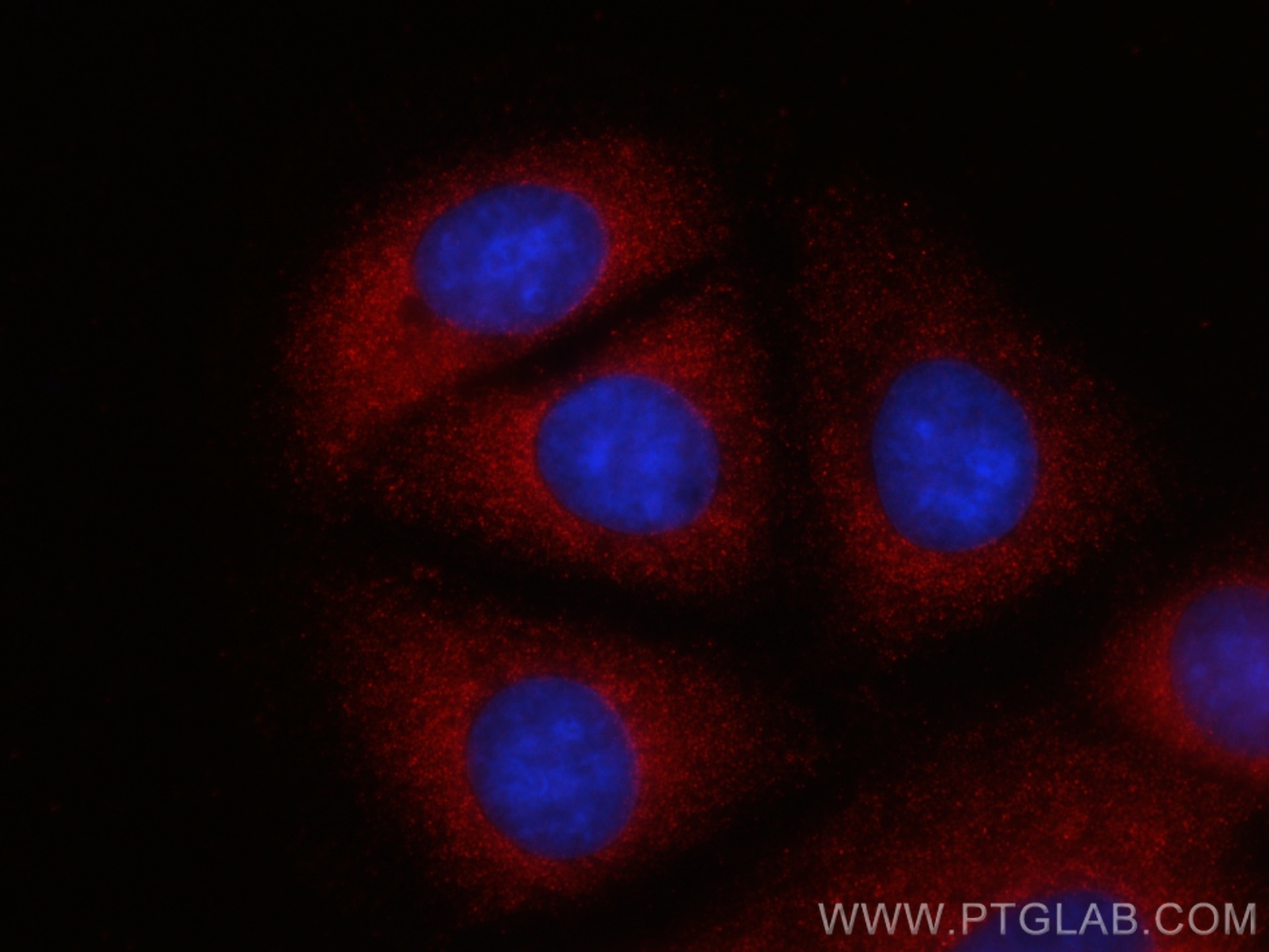 IF Staining of MCF-7 using CL594-67928