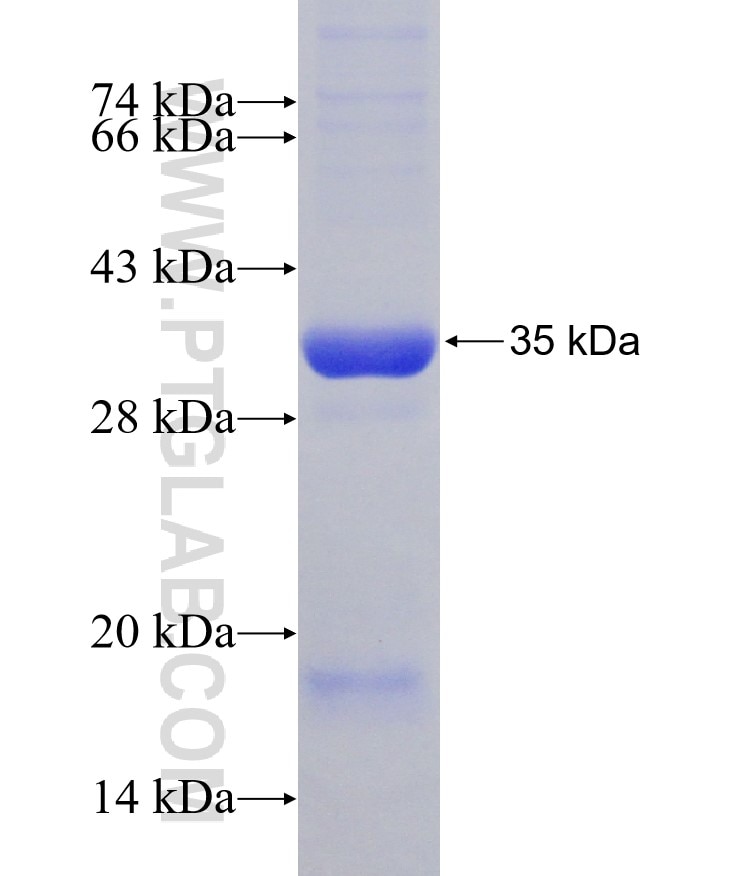 PSME1 fusion protein Ag30549 SDS-PAGE