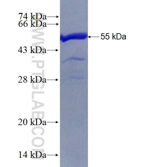 PSME1 fusion protein Ag0831 SDS-PAGE