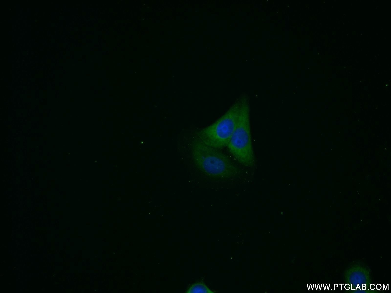 Immunofluorescence (IF) / fluorescent staining of MCF-7 cells using PSME2 Polyclonal antibody (12937-2-AP)