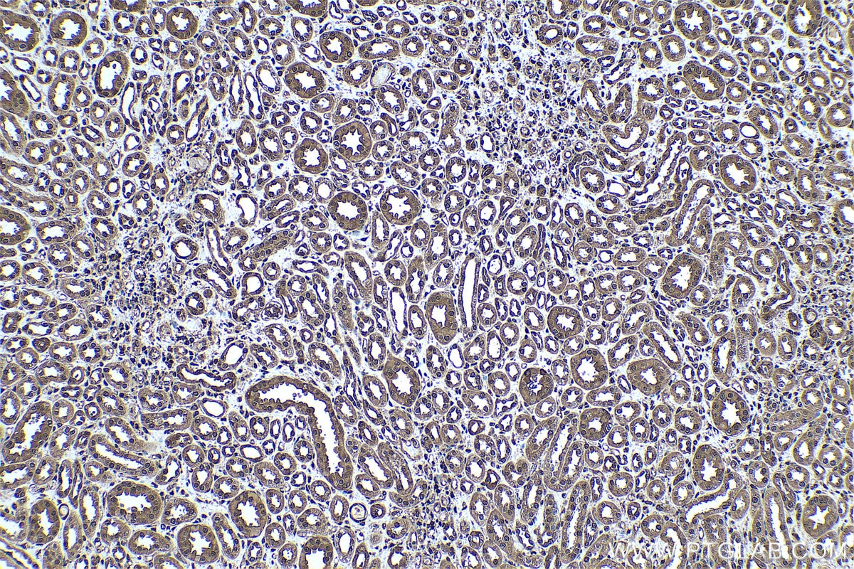 Immunohistochemistry (IHC) staining of human kidney tissue using PSME2 Polyclonal antibody (12937-2-AP)