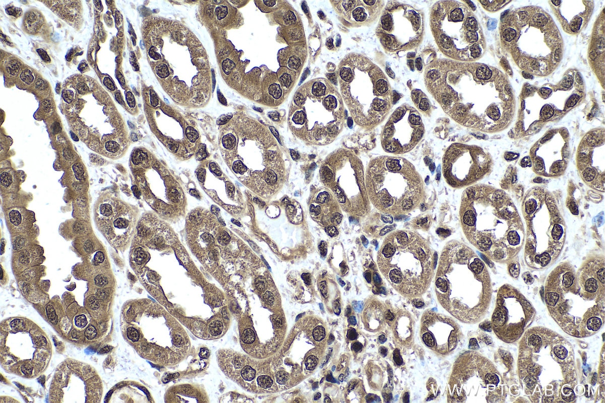 Immunohistochemistry (IHC) staining of human kidney tissue using PSME2 Polyclonal antibody (12937-2-AP)