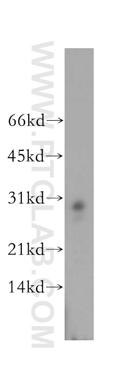 Western Blot (WB) analysis of human brain tissue using PSME2 Polyclonal antibody (12937-2-AP)