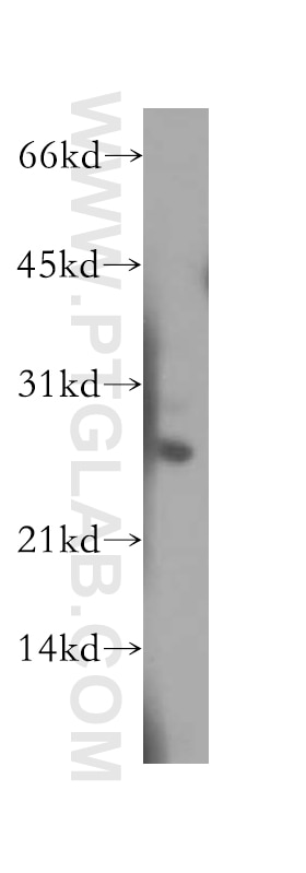 Western Blot (WB) analysis of mouse pancreas tissue using PSME2 Polyclonal antibody (12937-2-AP)