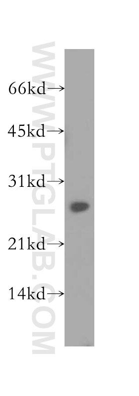 Western Blot (WB) analysis of MCF-7 cells using PSME2 Polyclonal antibody (12937-2-AP)