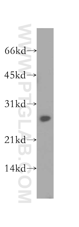 Western Blot (WB) analysis of MCF-7 cells using PSME2 Polyclonal antibody (12937-2-AP)