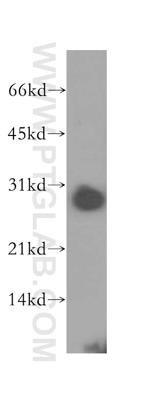 Western Blot (WB) analysis of human kidney tissue using PSME2 Polyclonal antibody (12937-2-AP)