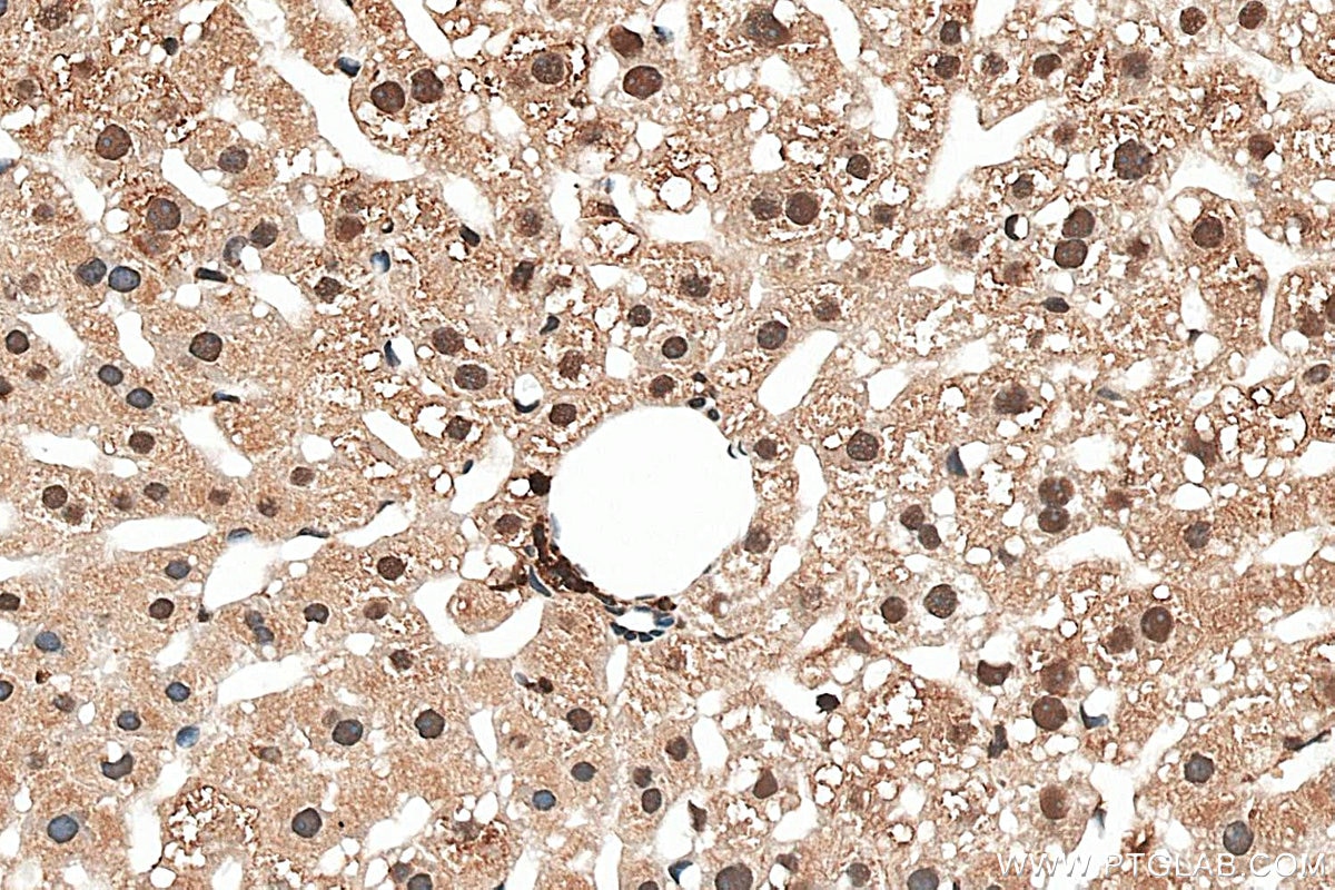 IHC staining of mouse liver using 87958-1-RR (same clone as 87958-1-PBS) Immunohistochemistry (IHC) staining of mouse liver tissue using PSME2 Recombinant monoclonal antibody (87958-1-RR)
