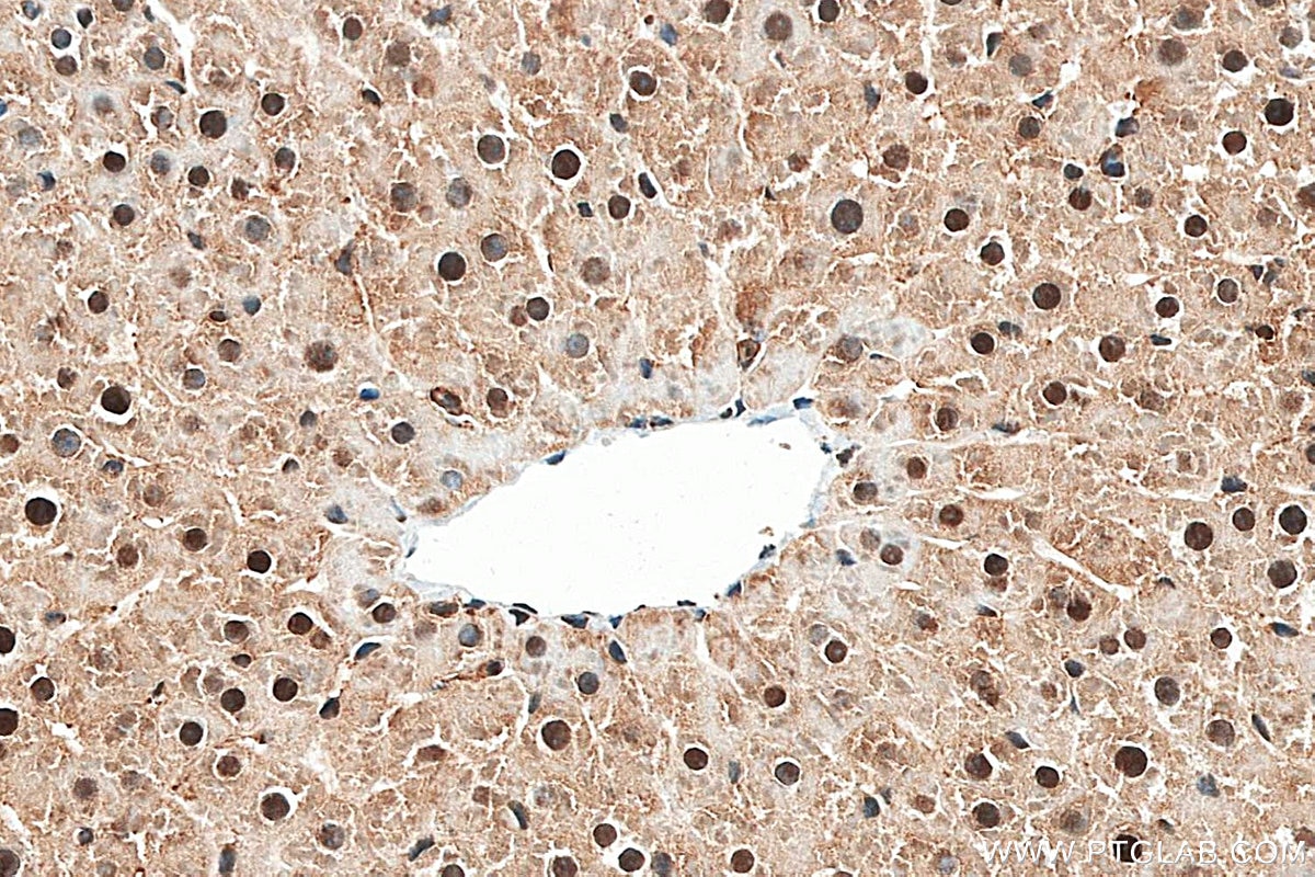 IHC staining of rat liver using 87958-1-RR (same clone as 87958-1-PBS) Immunohistochemistry (IHC) staining of rat liver tissue using PSME2 Recombinant monoclonal antibody (87958-1-RR)