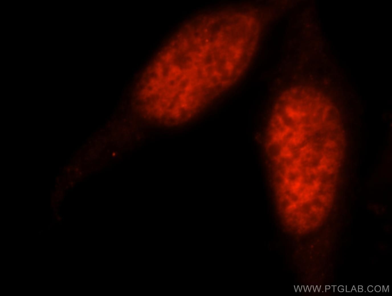 Immunofluorescence (IF) / fluorescent staining of HepG2 cells using PSME3 Polyclonal antibody (14907-1-AP)