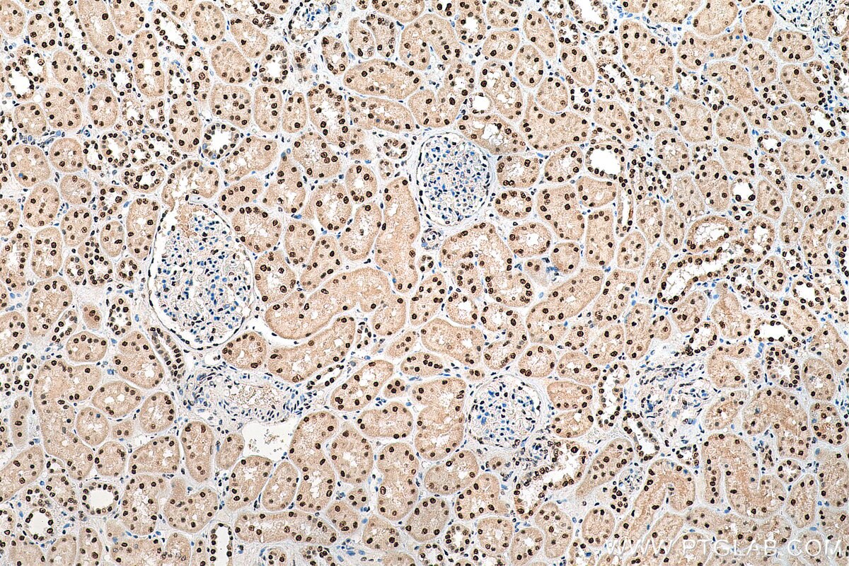 Immunohistochemistry (IHC) staining of human kidney tissue using PSME3 Polyclonal antibody (14907-1-AP)