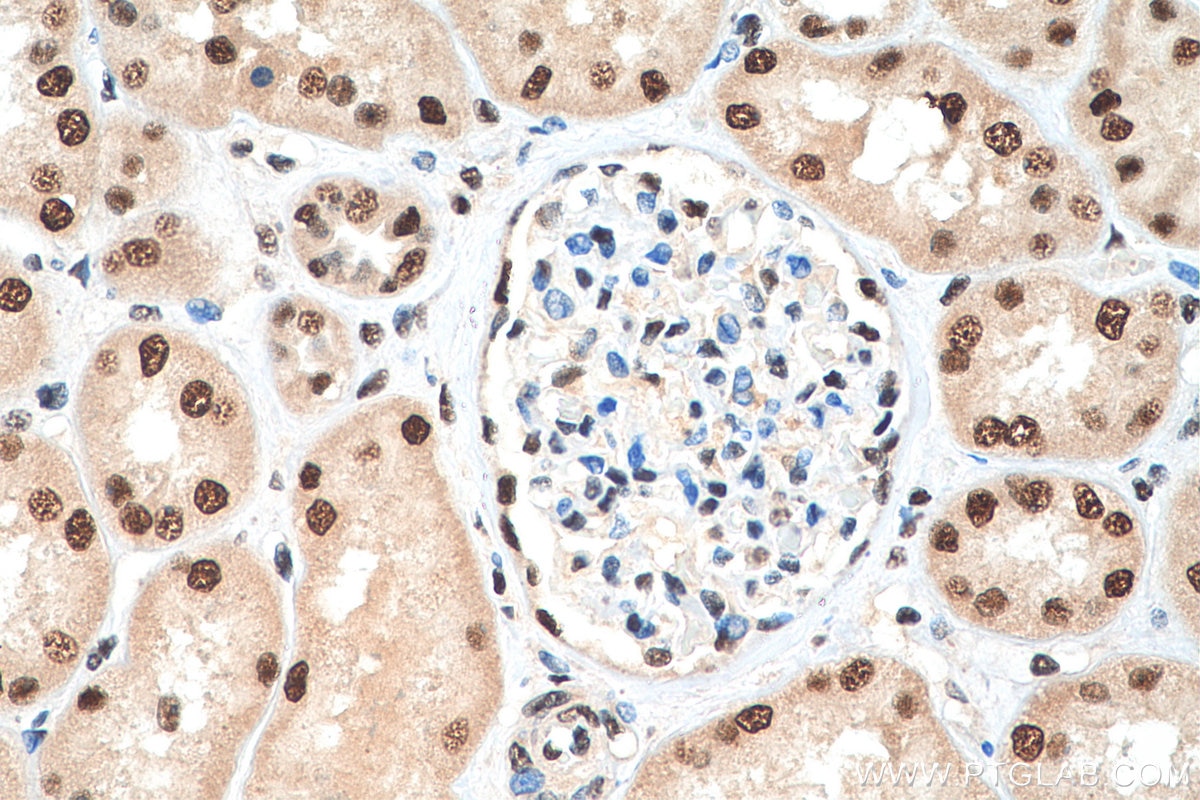 Immunohistochemistry (IHC) staining of human kidney tissue using PSME3 Polyclonal antibody (14907-1-AP)