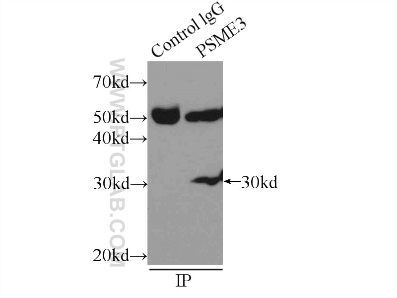 Immunoprecipitation (IP) experiment of COLO 320 cells using PSME3 Polyclonal antibody (14907-1-AP)