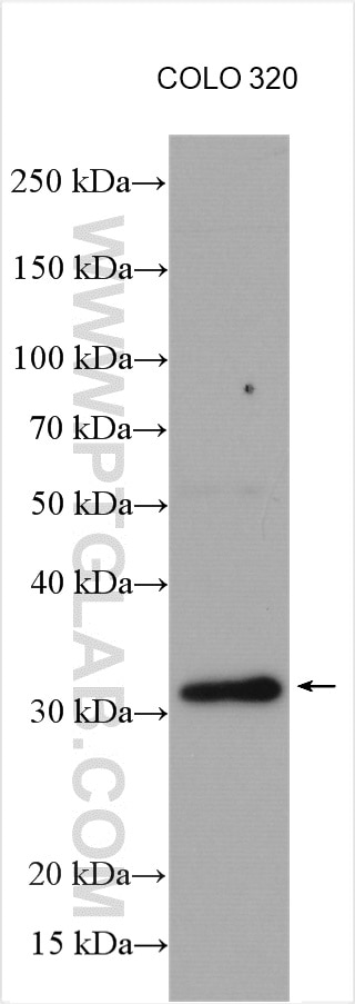 Western Blot (WB) analysis of various lysates using PSME3 Polyclonal antibody (14907-1-AP)