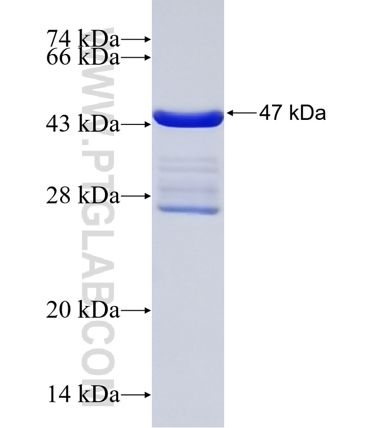PSME3 fusion protein Ag31969 SDS-PAGE