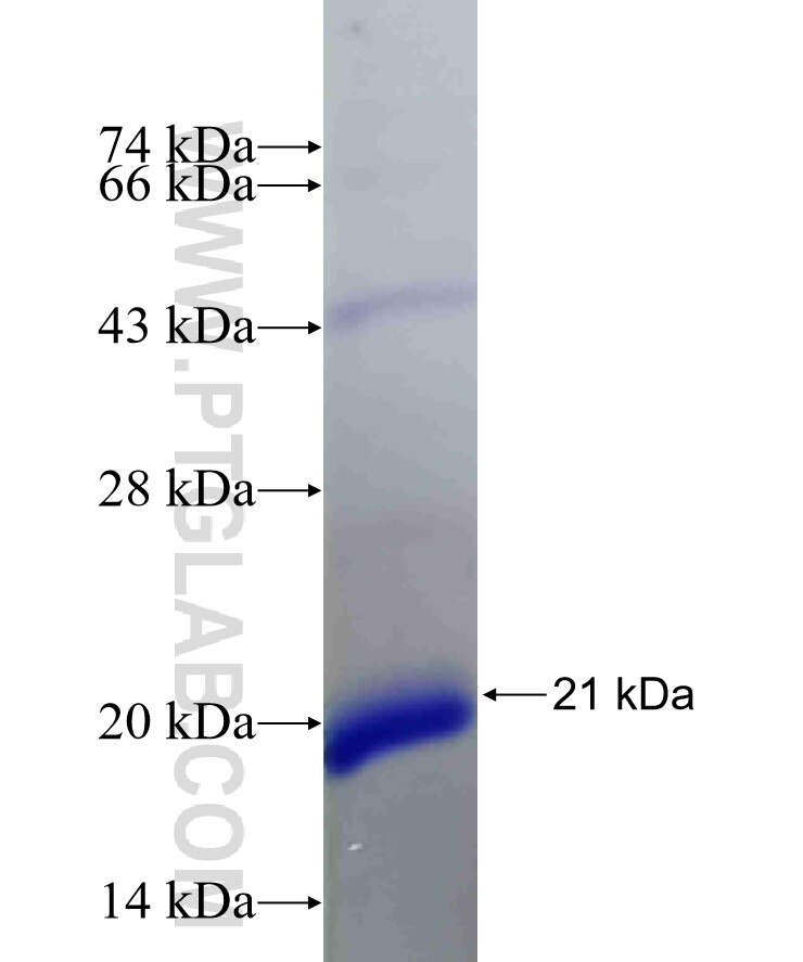 PSME3 fusion protein Ag31985 SDS-PAGE