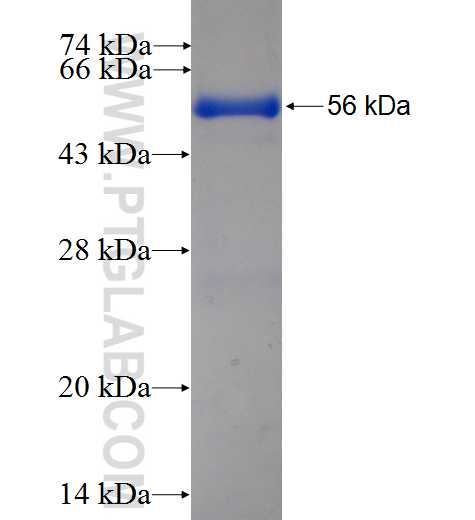 PSME3 fusion protein Ag6702 SDS-PAGE