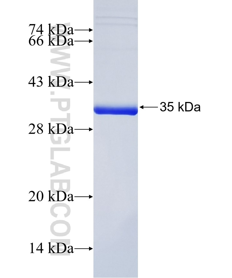 PSME3 fusion protein Ag6716 SDS-PAGE
