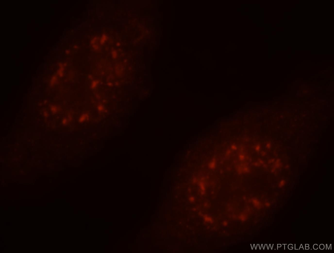 IF Staining of HepG2 using 18799-1-AP