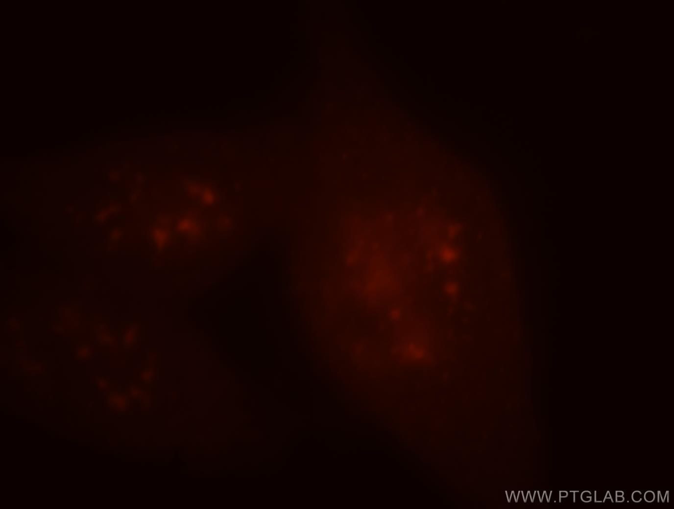 Immunofluorescence (IF) / fluorescent staining of HeLa cells using PSME4 Polyclonal antibody (18799-1-AP)