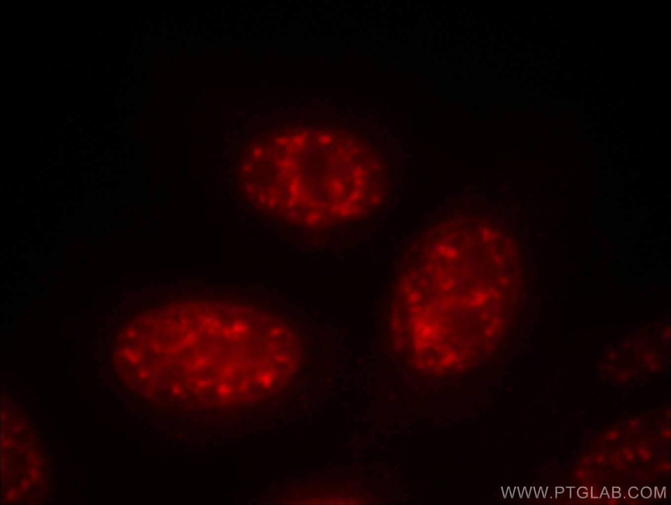 Immunofluorescence (IF) / fluorescent staining of HepG2 cells using PSME4 Polyclonal antibody (18799-1-AP)