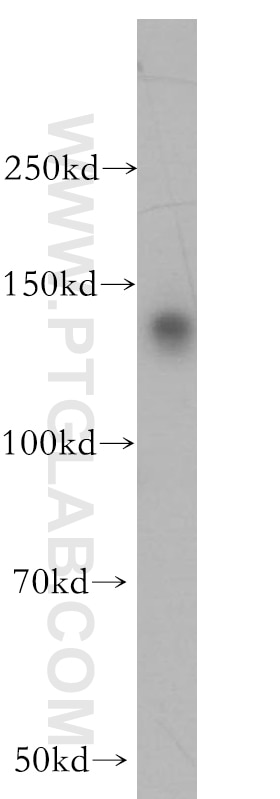 Western Blot (WB) analysis of HepG2 cells using PSME4 Polyclonal antibody (18799-1-AP)