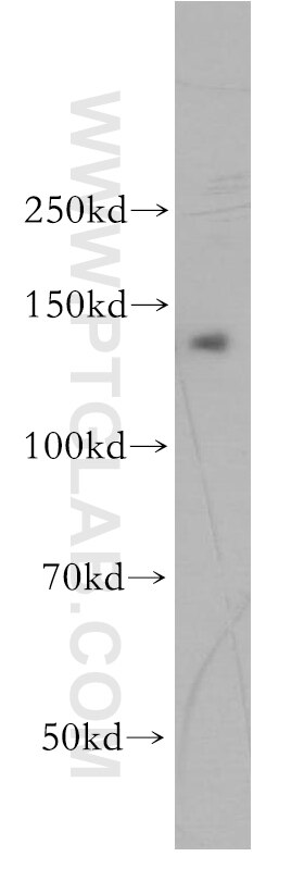 Western Blot (WB) analysis of HepG2 cells using PSME4 Polyclonal antibody (18799-1-AP)