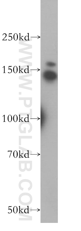 Western Blot (WB) analysis of HEK-293 cells using PSME4 Polyclonal antibody (18799-1-AP)