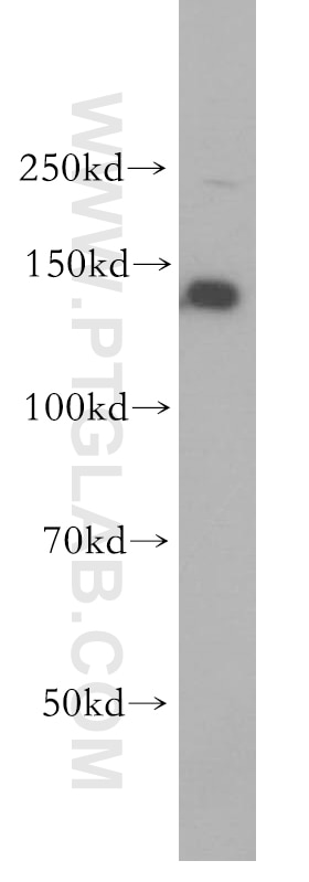 Western Blot (WB) analysis of HEK-293 cells using PSME4 Polyclonal antibody (18799-1-AP)