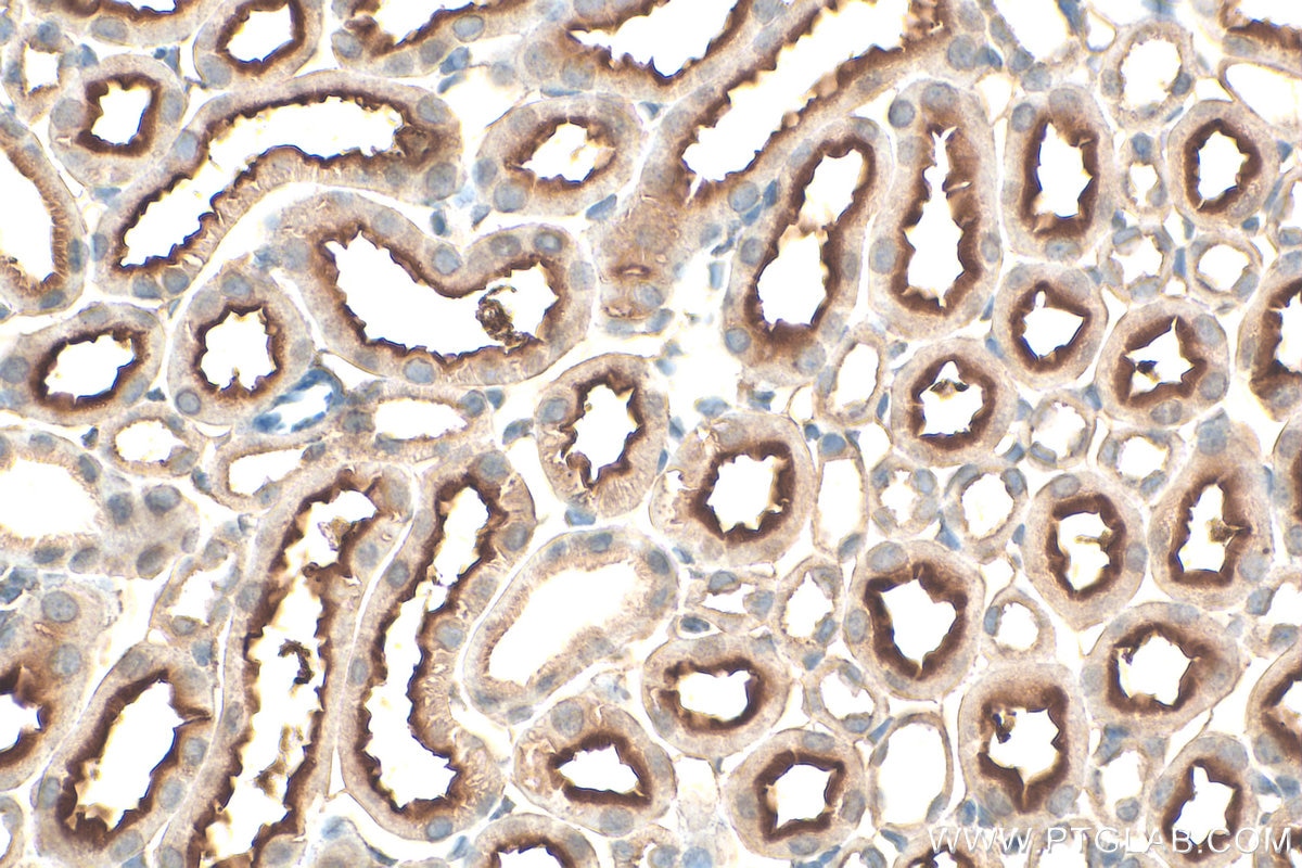 Immunohistochemistry (IHC) staining of mouse kidney tissue using PSMF1 Polyclonal antibody (12941-1-AP)