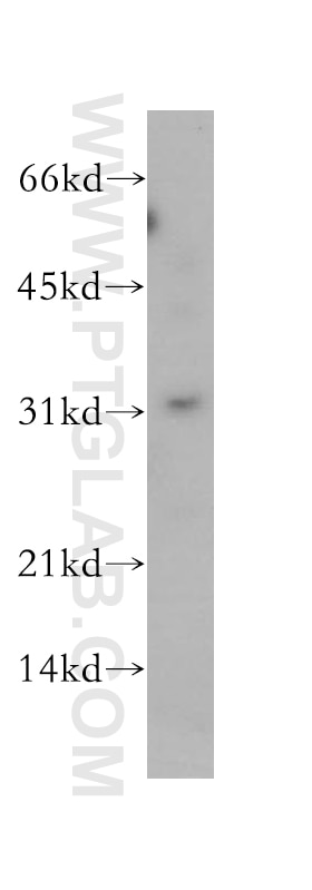 Western Blot (WB) analysis of human kidney tissue using PSMF1 Polyclonal antibody (12941-1-AP)