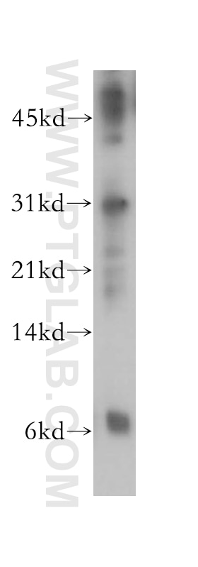 Western Blot (WB) analysis of human heart tissue using PSMF1 Polyclonal antibody (12941-1-AP)