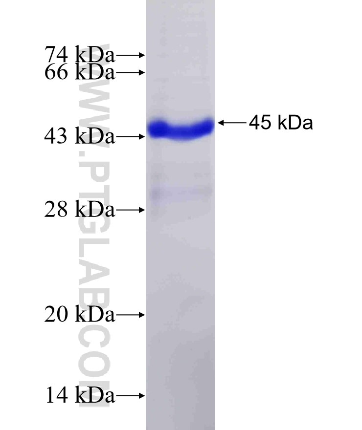 PSMG1 fusion protein Ag0303 SDS-PAGE