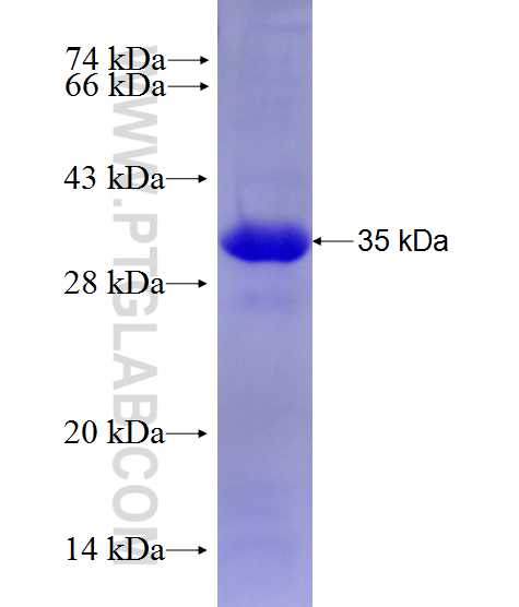 PSMG2 fusion protein Ag27858 SDS-PAGE