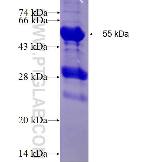 PSMG2 fusion protein Ag1400 SDS-PAGE