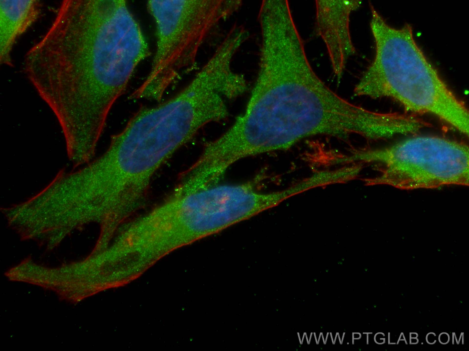 Immunofluorescence (IF) / fluorescent staining of HeLa cells using PSMG3 Monoclonal antibody (67466-1-Ig)