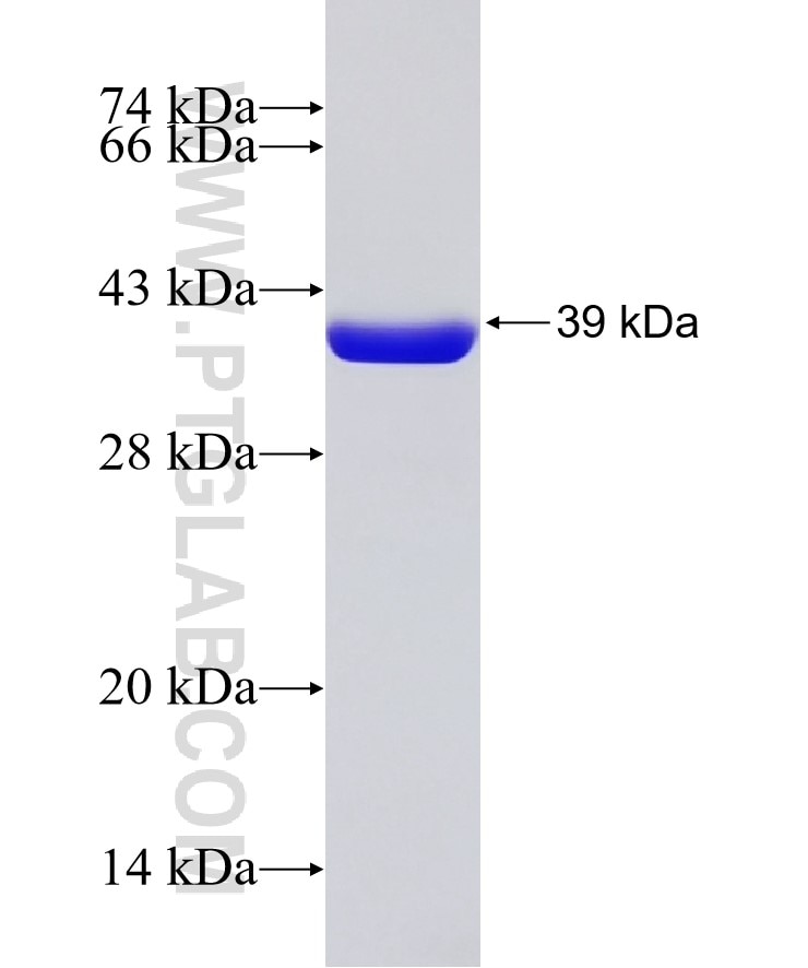 PSMG3 fusion protein Ag7984 SDS-PAGE