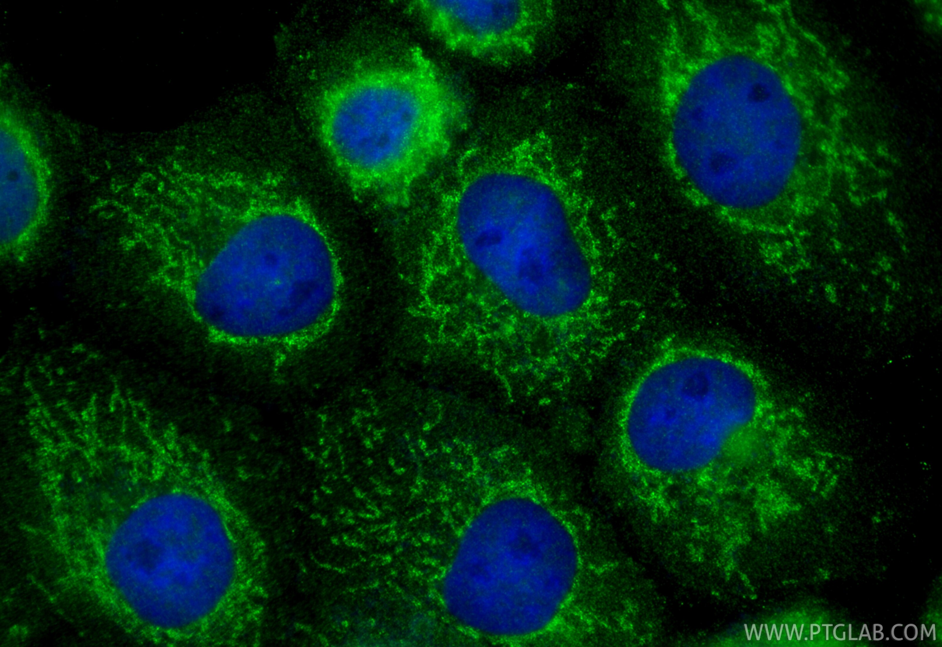 Immunofluorescence (IF) / fluorescent staining of A431 cells using PSMG4 Polyclonal antibody (31201-1-AP)