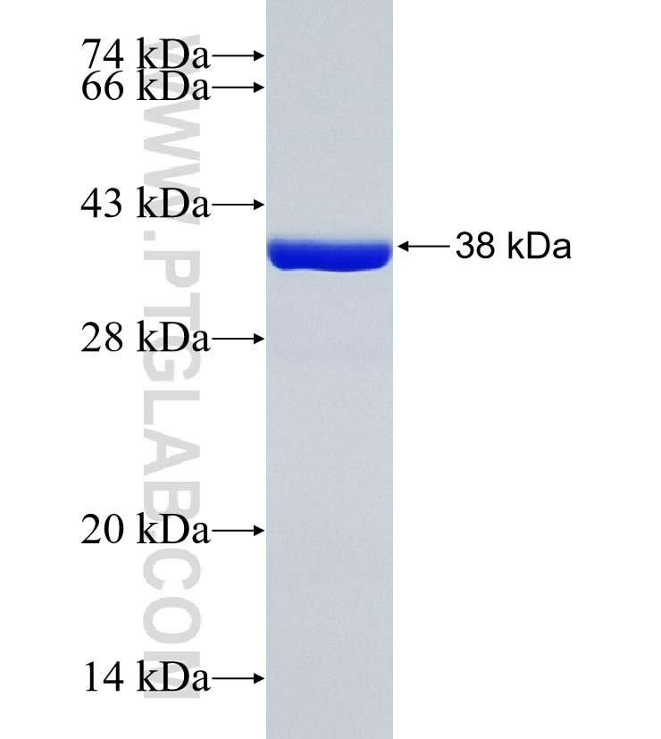 PSMG4 fusion protein Ag35222 SDS-PAGE PSMG4 fusion protein Ag35222 SDS-PAGE