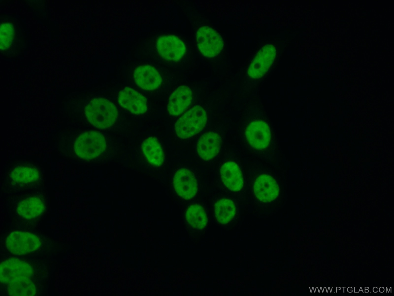 IF Staining of PC-3 using 16714-1-AP