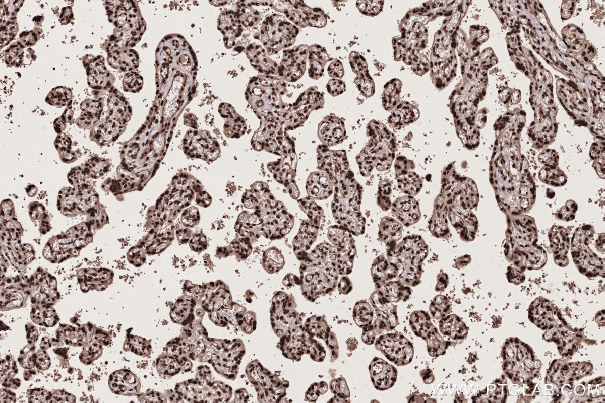 Immunohistochemistry (IHC) staining of human placenta tissue using PSPC1 Polyclonal antibody (16714-1-AP)
