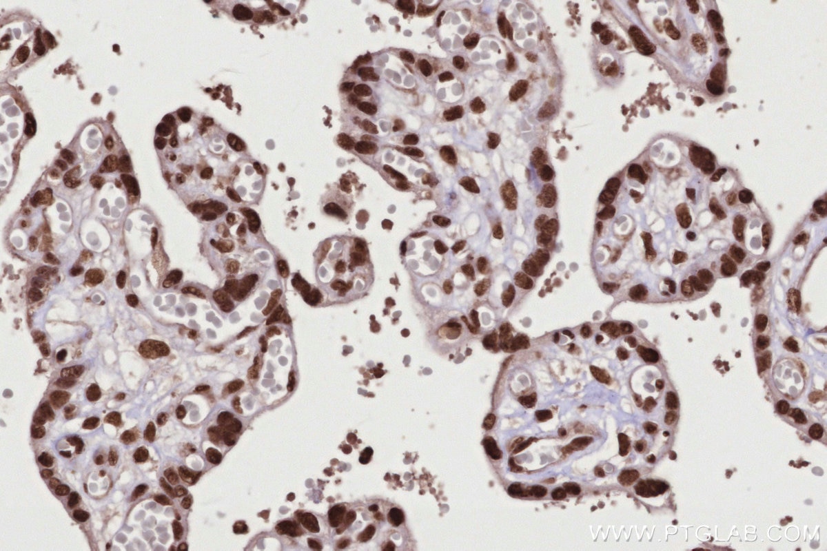 Immunohistochemistry (IHC) staining of human placenta tissue using PSPC1 Polyclonal antibody (16714-1-AP)