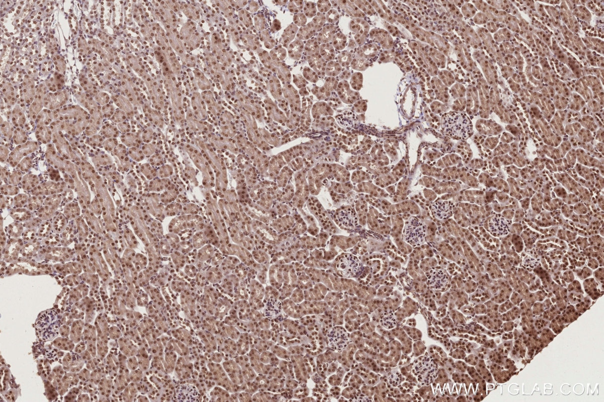 Immunohistochemistry (IHC) staining of mouse kidney tissue using PSPC1 Polyclonal antibody (16714-1-AP)