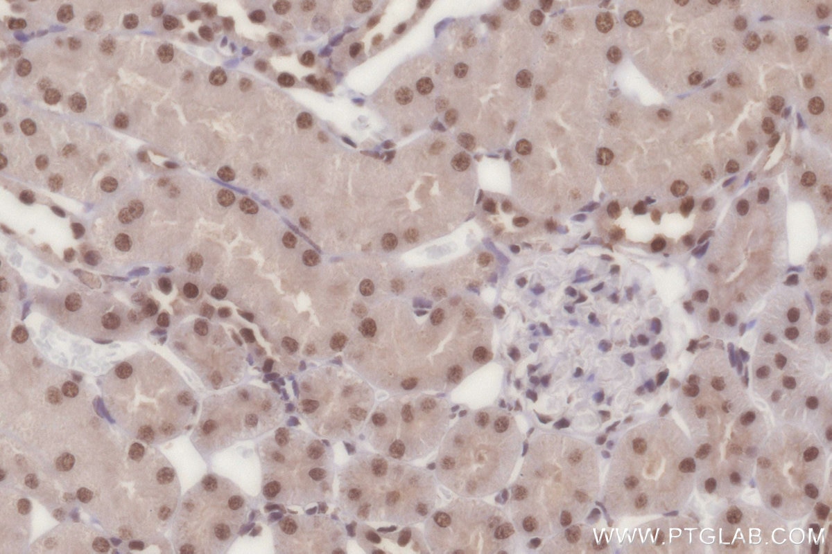 Immunohistochemistry (IHC) staining of rat kidney tissue using PSPC1 Polyclonal antibody (16714-1-AP)