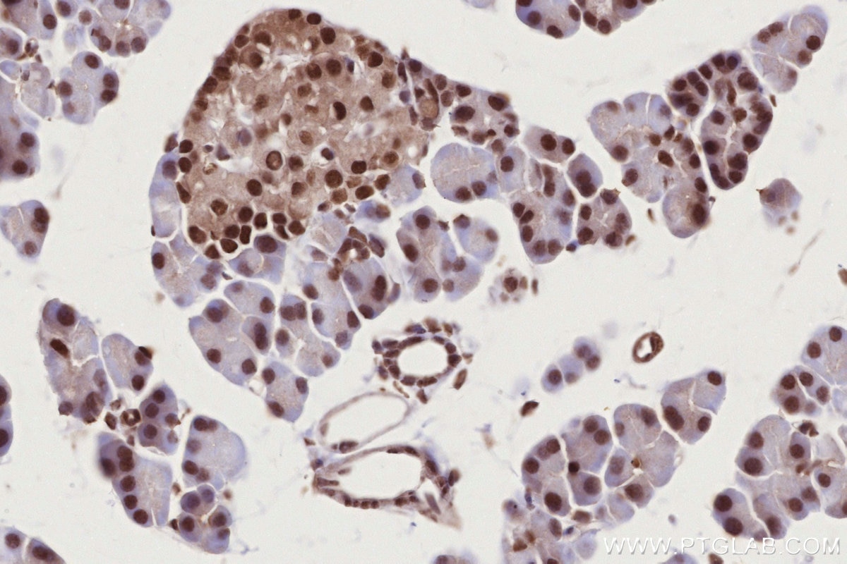 Immunohistochemistry (IHC) staining of rat pancreas tissue using PSPC1 Polyclonal antibody (16714-1-AP)