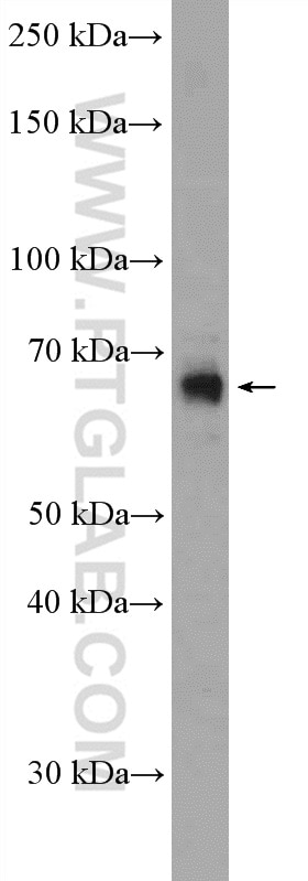 PSPC1 Polyclonal antibody