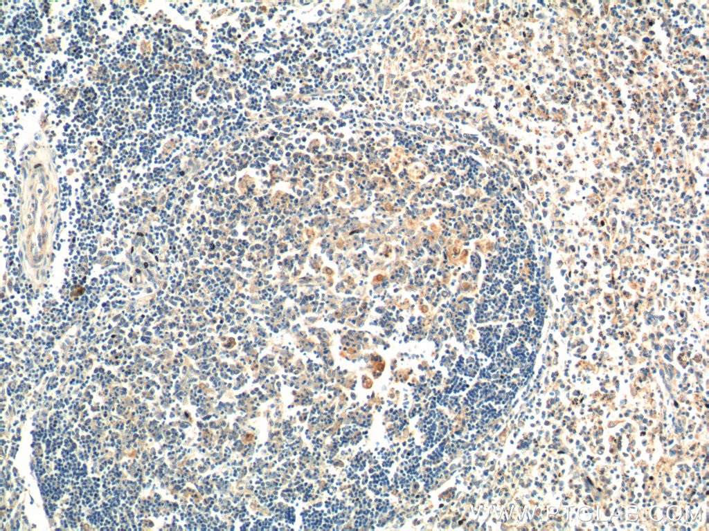 Immunohistochemistry (IHC) staining of human spleen tissue using PSPH Polyclonal antibody (14513-1-AP)