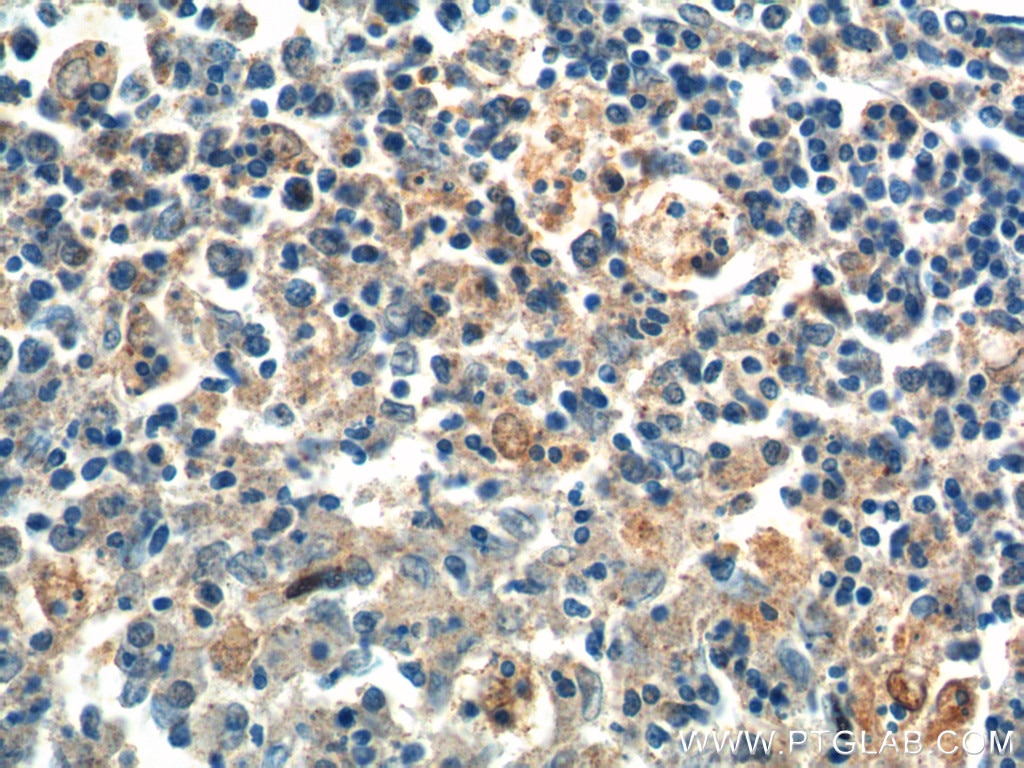 Immunohistochemistry (IHC) staining of human spleen tissue using PSPH Polyclonal antibody (14513-1-AP)